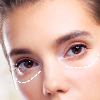 Under-Eye
