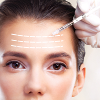 Forehead & Glabella